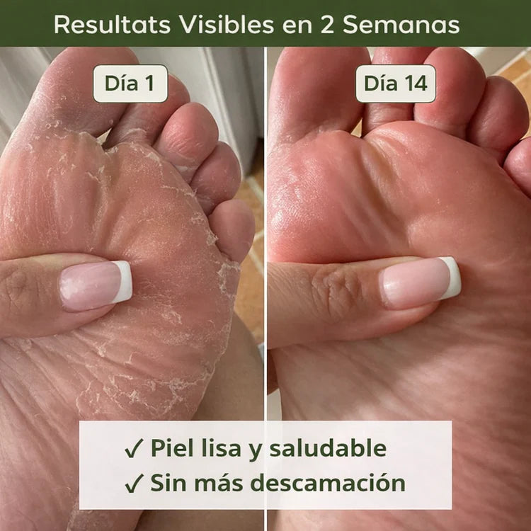 Jabón purificante antifúngico Nola®