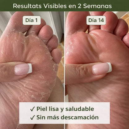 Jabón purificante antifúngico Nola®