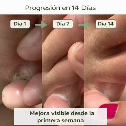 Jabón purificante antifúngico Nola®